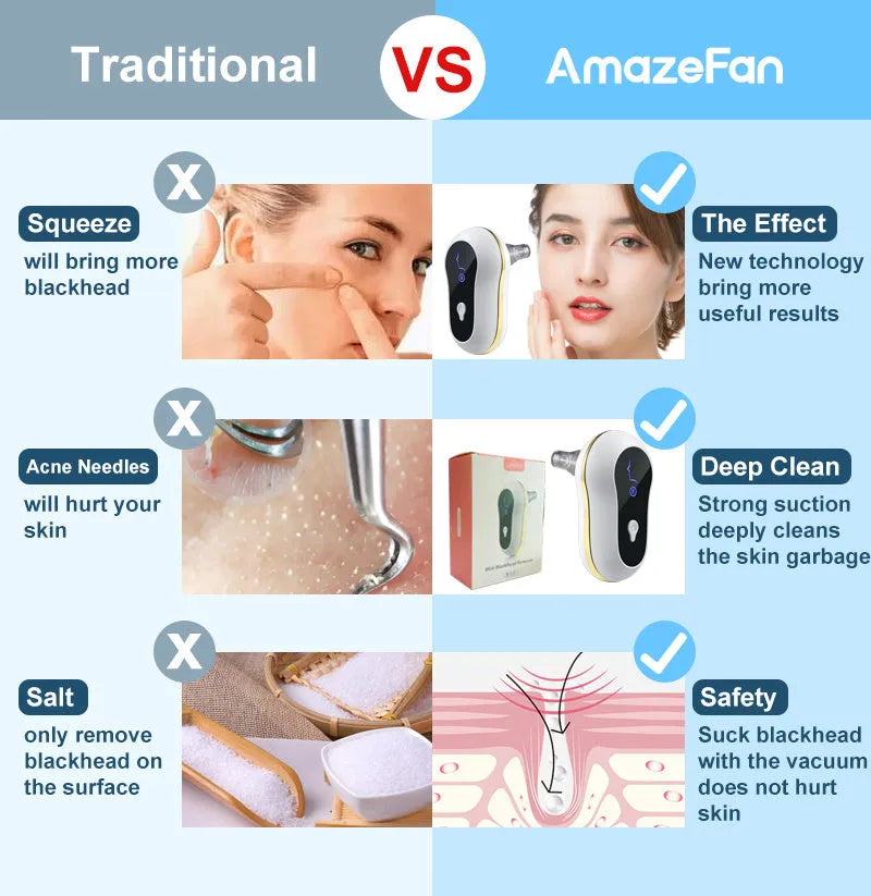 Electric blackhead remover vacuum kit with adjustable 3-level suction, USB model, red or white, for pore cleaning.