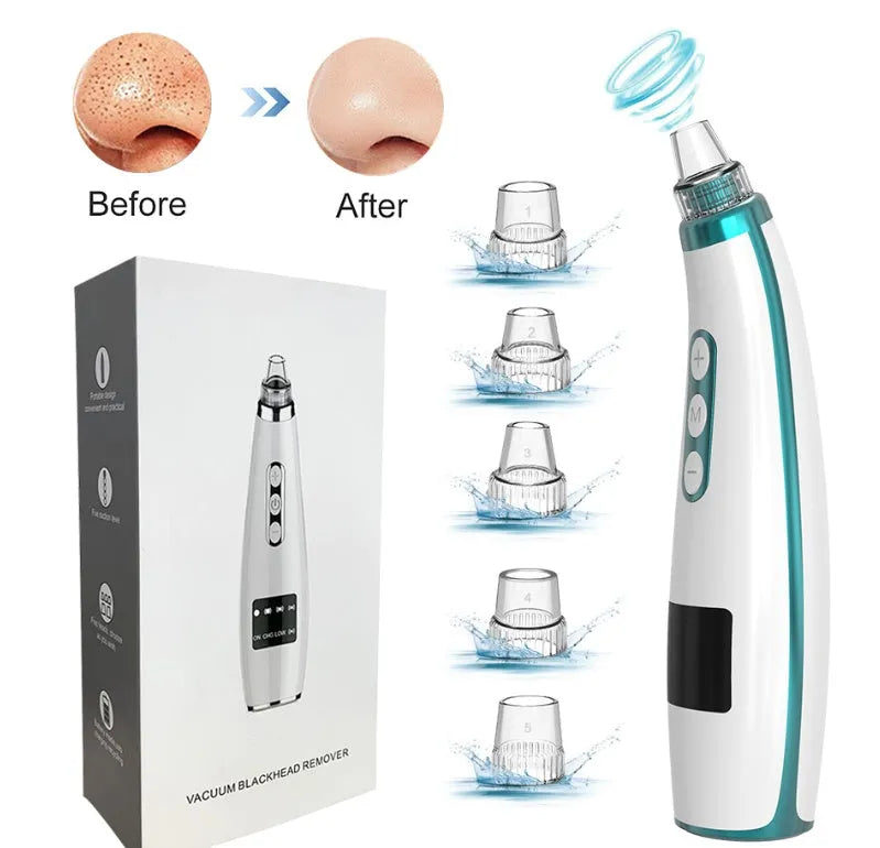Electric blackhead suction instrument in black, 173x44x40mm, with five gear settings and USB charging