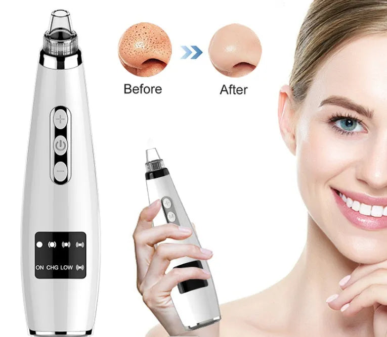Electric blackhead suction instrument in black, 173x44x40mm, with five gear settings and USB charging