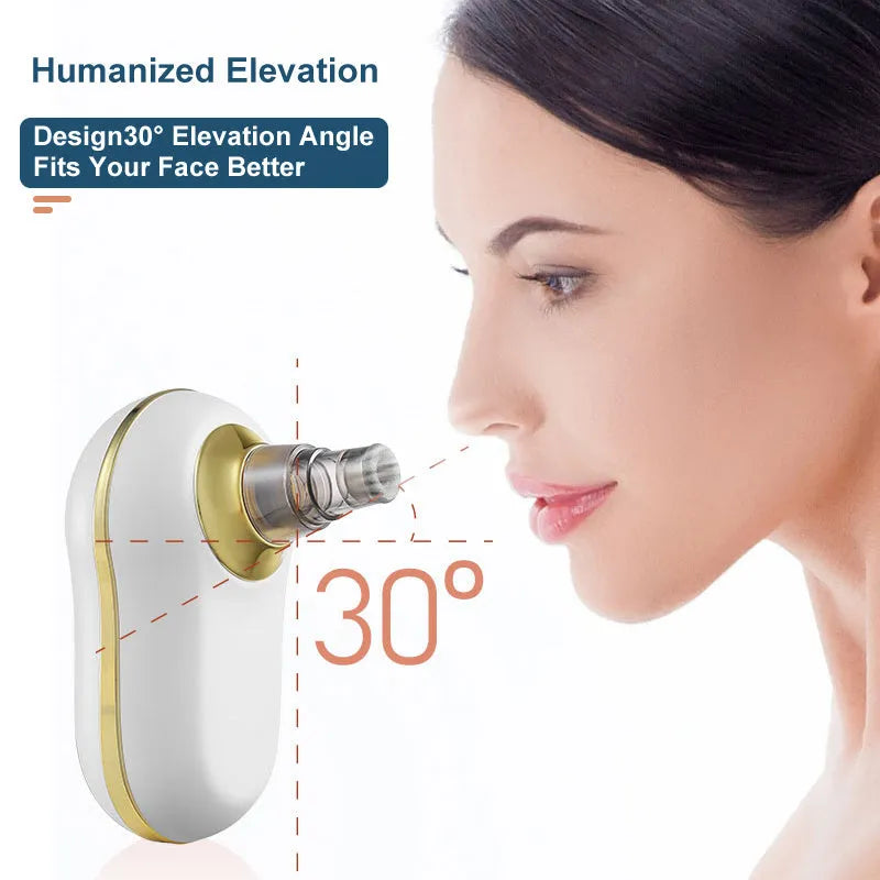 Electric blackhead remover vacuum kit with adjustable 3-level suction, USB model, red or white, for pore cleaning.