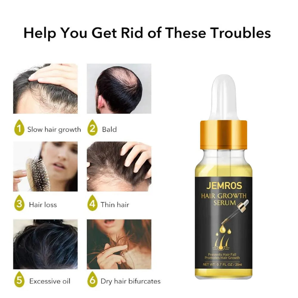 20ml hair growth essential oil liquid in plastic packaging for scalp nourishment and anti-hair loss