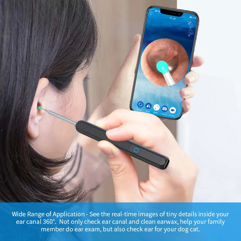 NE3 wireless otoscope ear cleaner with camera, spoon heads, and charging cable on a white background.