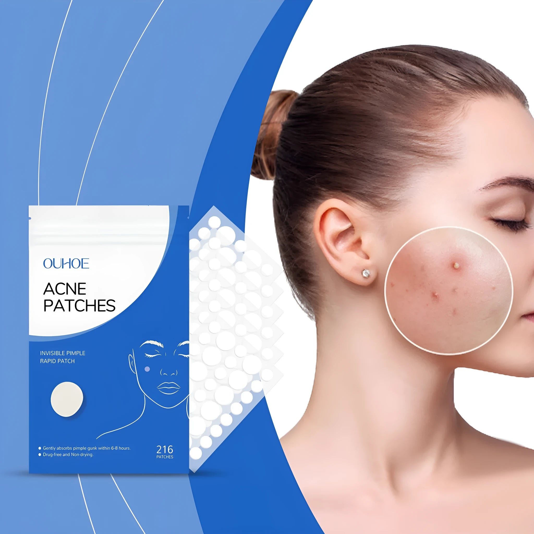 216 hydrocolloid acne patches in packaging with tea tree oil and vitamin E formulation
