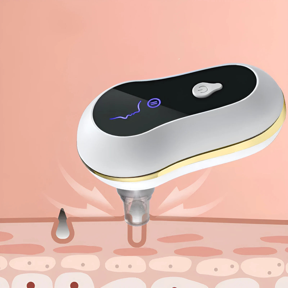 Electric blackhead remover vacuum kit with adjustable 3-level suction, USB model, red or white, for pore cleaning.