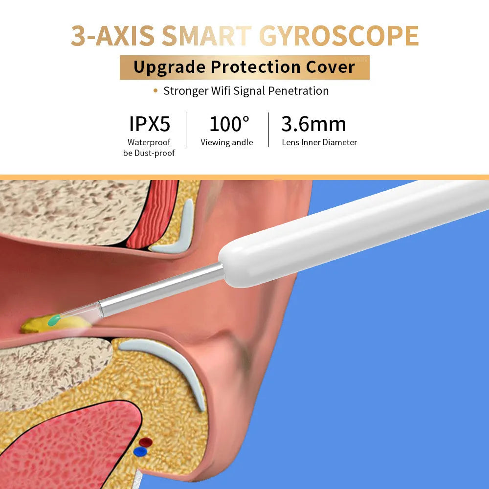 NE3 wireless otoscope ear cleaner with camera, spoon heads, and charging cable on a white background.