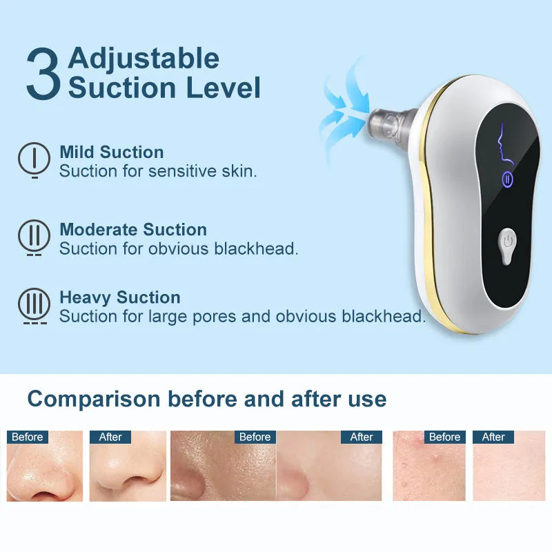 Electric blackhead remover vacuum kit with adjustable 3-level suction, USB model, red or white, for pore cleaning.