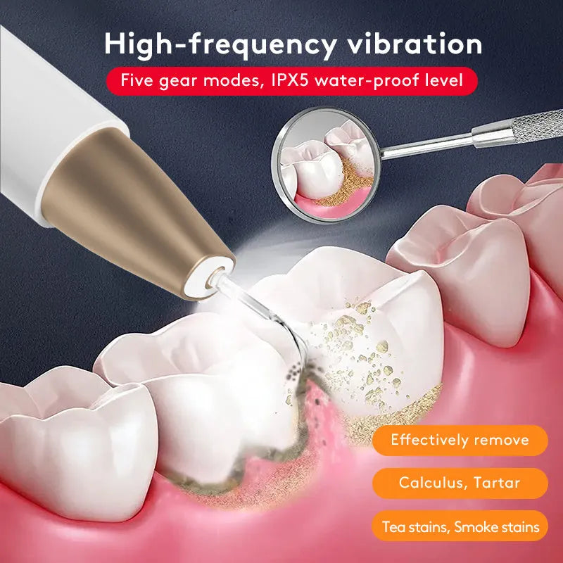 Gold ultrasonic tooth cleaning device for tartar removal and stain reduction
