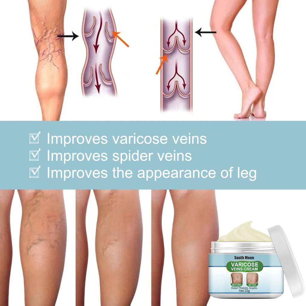 20g tube of vein repair cream for leg circulation and visible vein relief