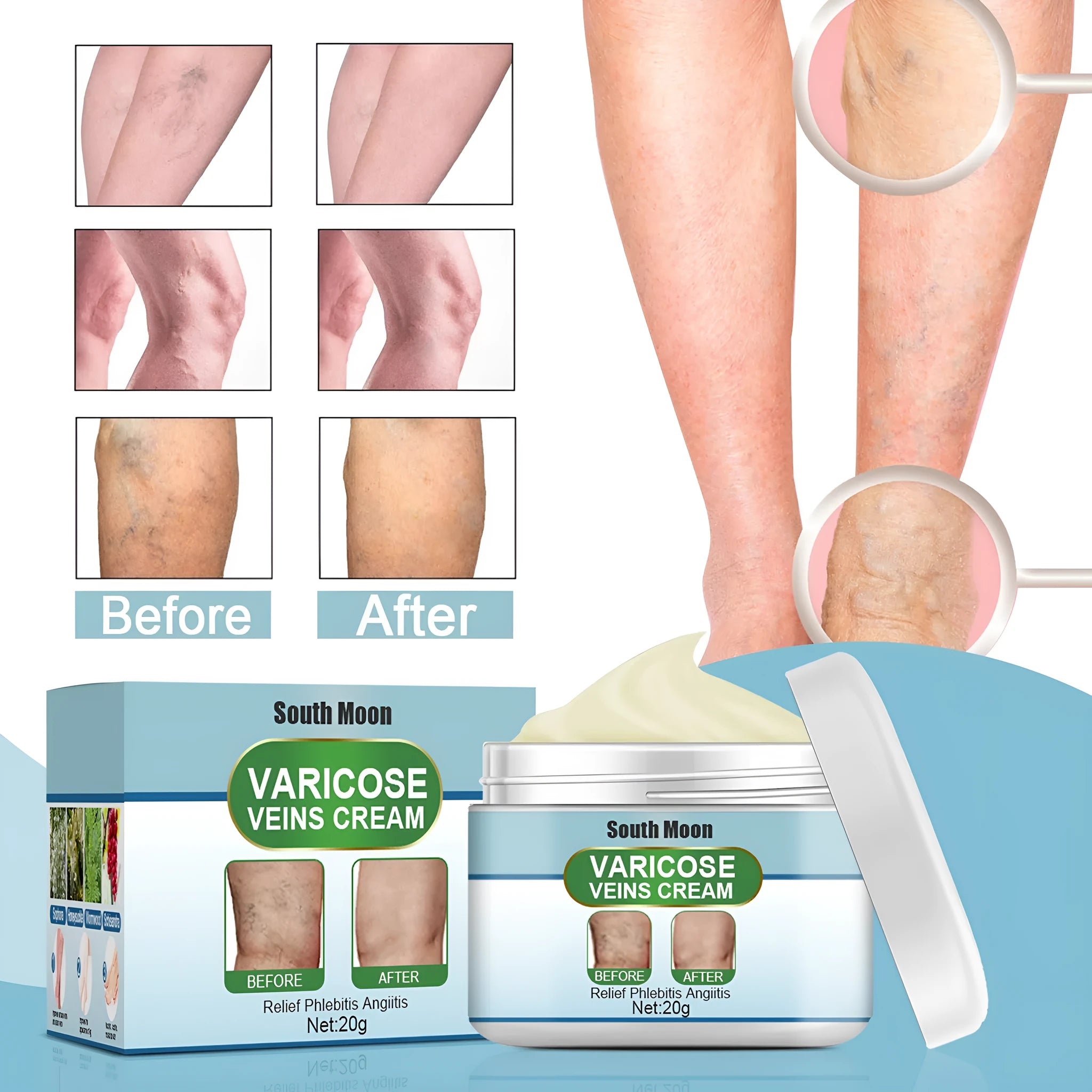 20g tube of vein repair cream for leg circulation and visible vein relief