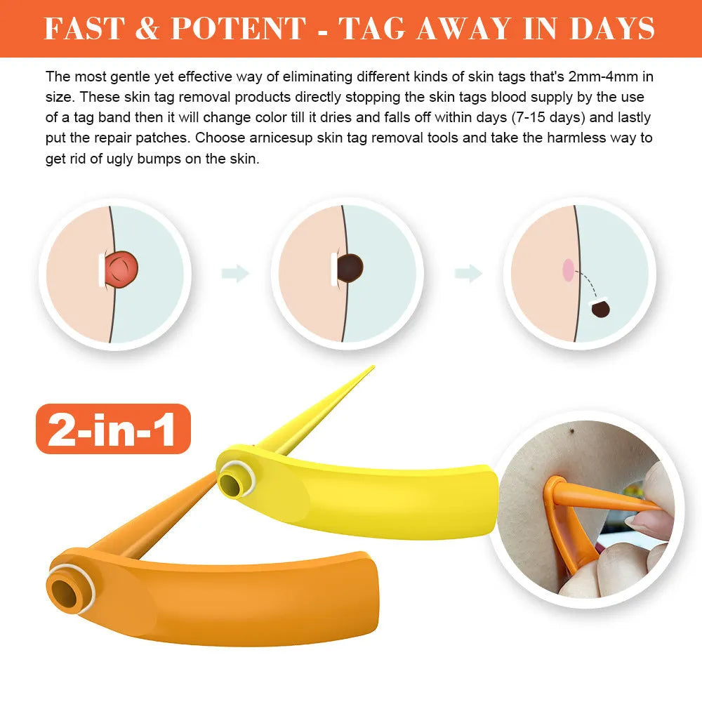 Orange yellow manual mole remover tool with metal cones, assorted rubber rings, alcohol swabs, and repair stickers on a white background.
