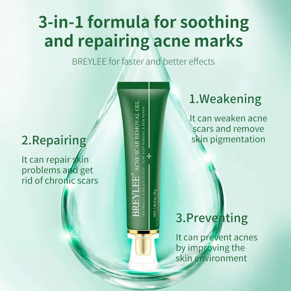 Green tube of acne scar removal gel with tea tree oil, 30g size on white background