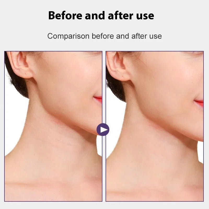 Skin tone neck firming adhesive tape strips for wrinkle reduction and lifting support