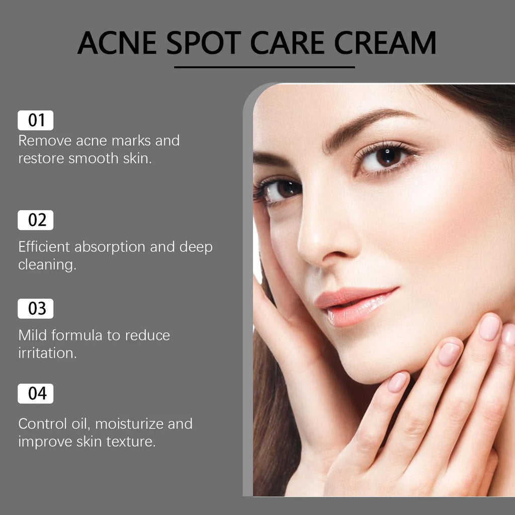 15g tube of acne cream with mint leaf, tea tree oil, and aloe leaf ingredients