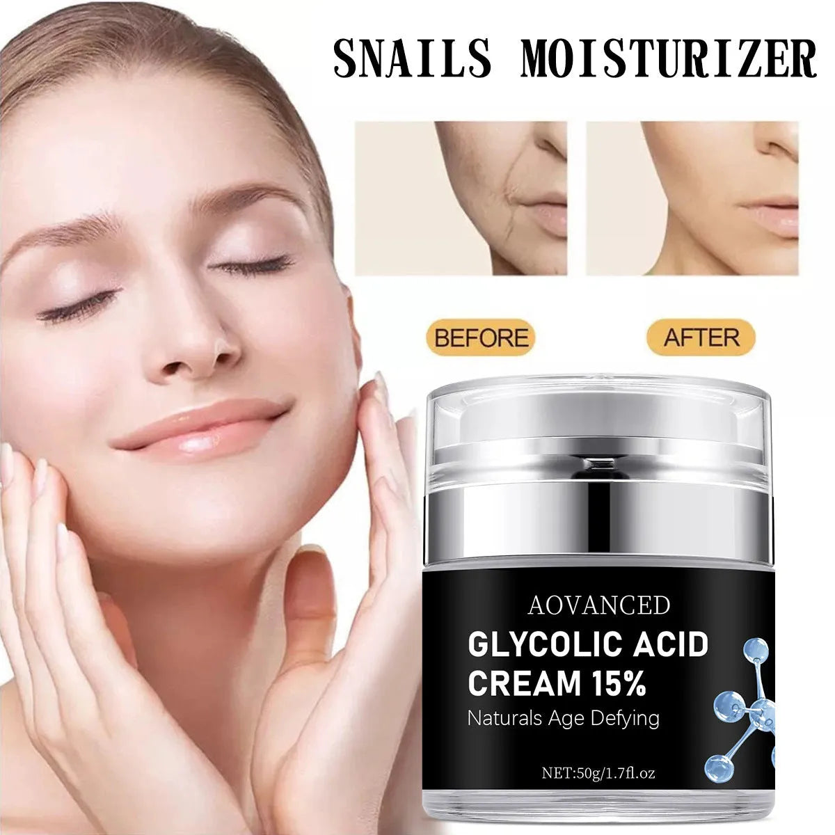 50g salicylic acid moisturising cream for exfoliation and smallpox treatment