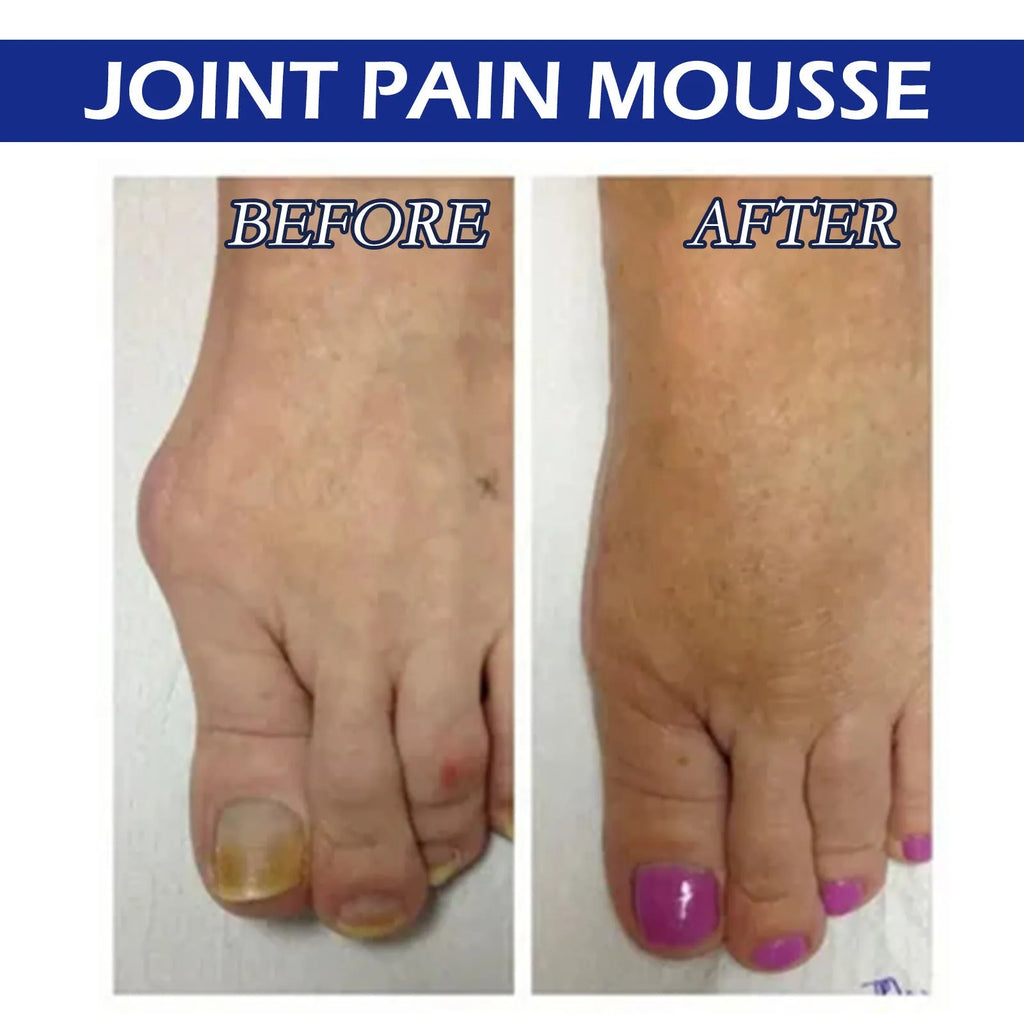 15ml bottle of herbal massage oil for body care and joint relief.