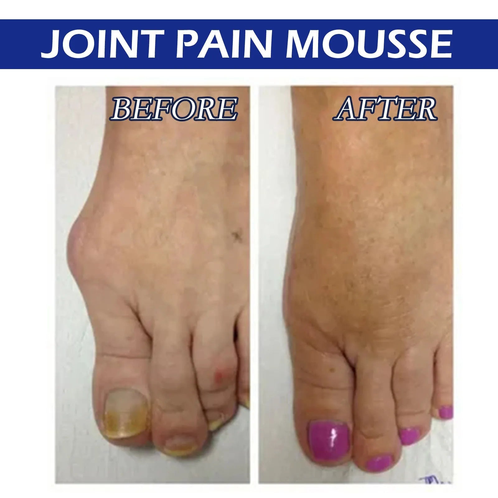 15ml bottle of herbal massage oil for body care and joint relief.
