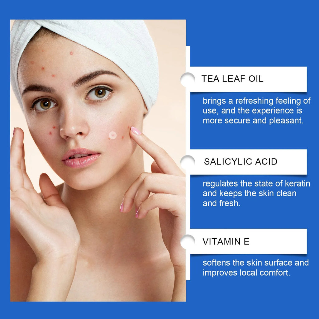 216 hydrocolloid acne patches in packaging with tea tree oil and vitamin E formulation