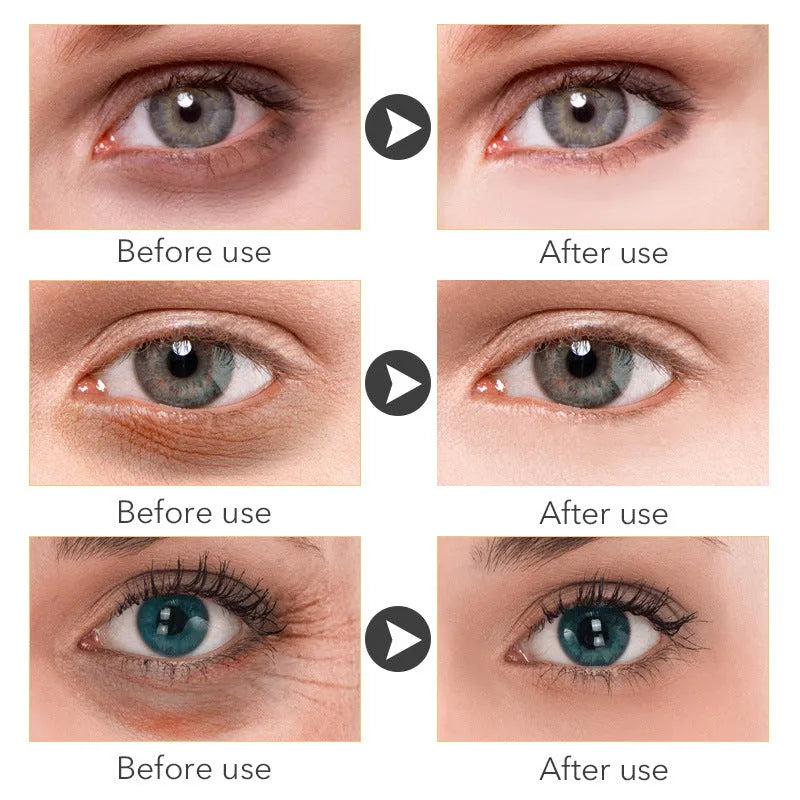 Beauty Eye Cream 30ml tube with hyaluronic acid and vitamin E formula for women's eye care