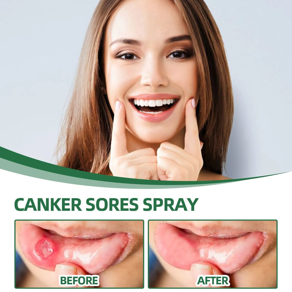 20ml mint flavour oral care spray in boxed packaging for breath freshening
