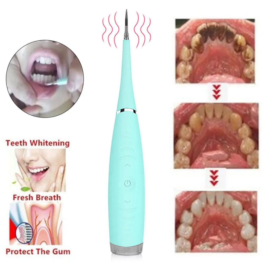 Pink and blue electric dental scaler tool with silicone handle on a bathroom counter.