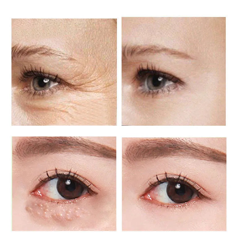 Beauty Eye Cream 30ml tube with hyaluronic acid and vitamin E formula for women's eye care