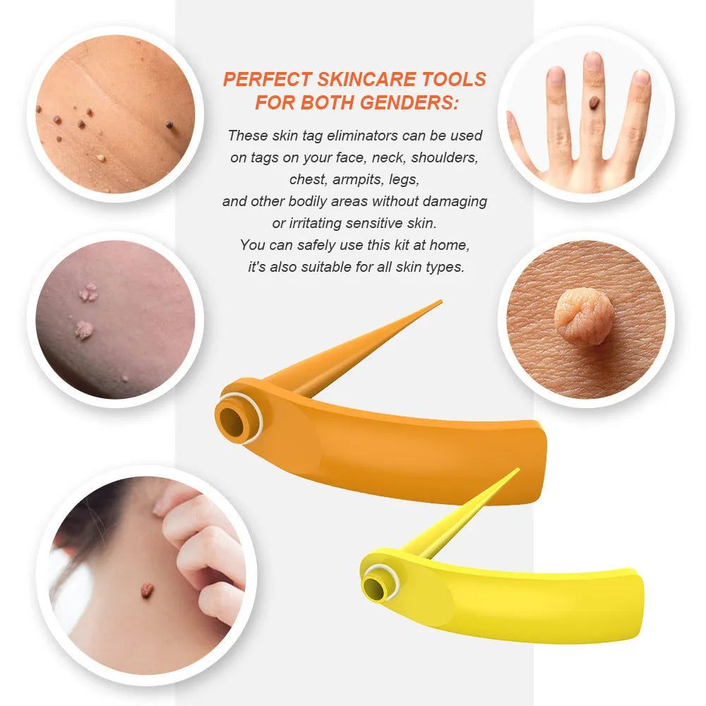 Orange yellow manual mole remover tool with metal cones, assorted rubber rings, alcohol swabs, and repair stickers on a white background.