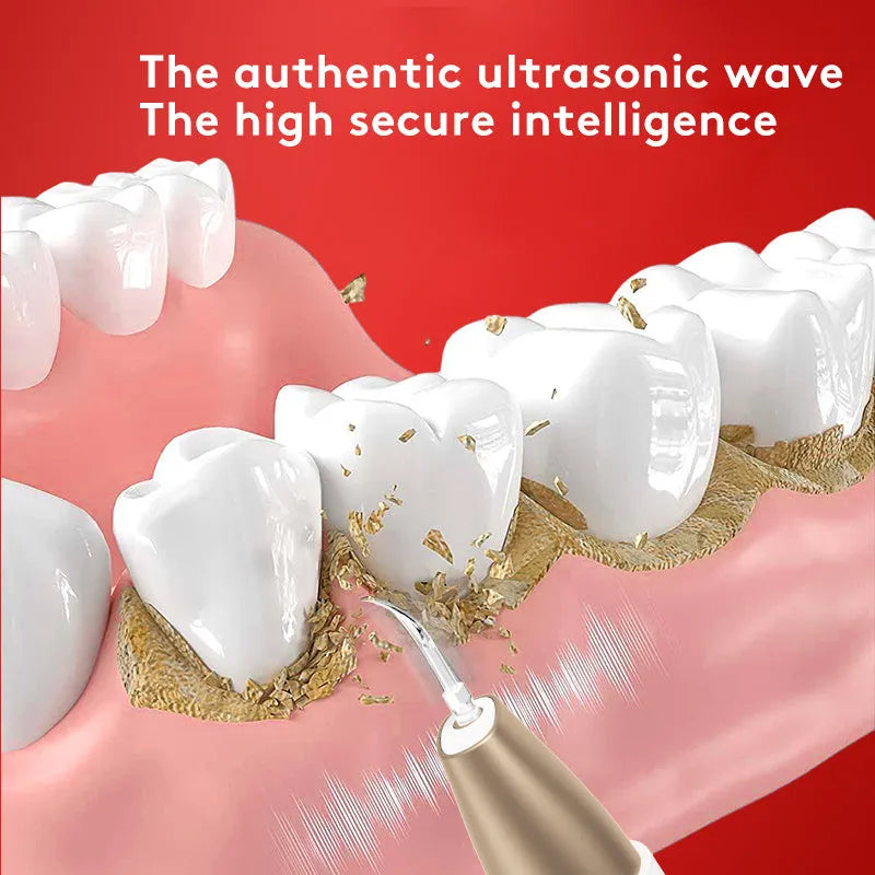 Gold ultrasonic tooth cleaning device for tartar removal and stain reduction