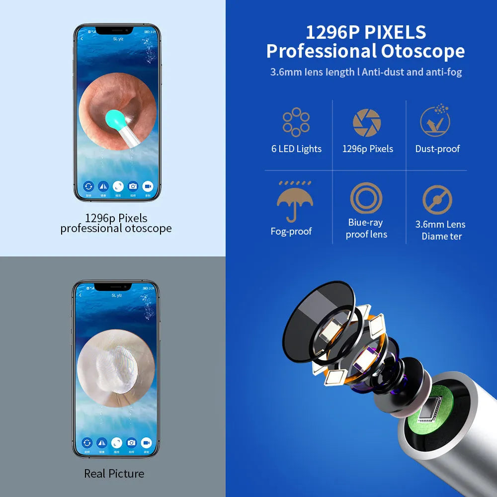 NE3 wireless otoscope ear cleaner with camera, spoon heads, and charging cable on a white background.
